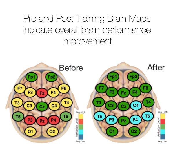 brain performance improvement